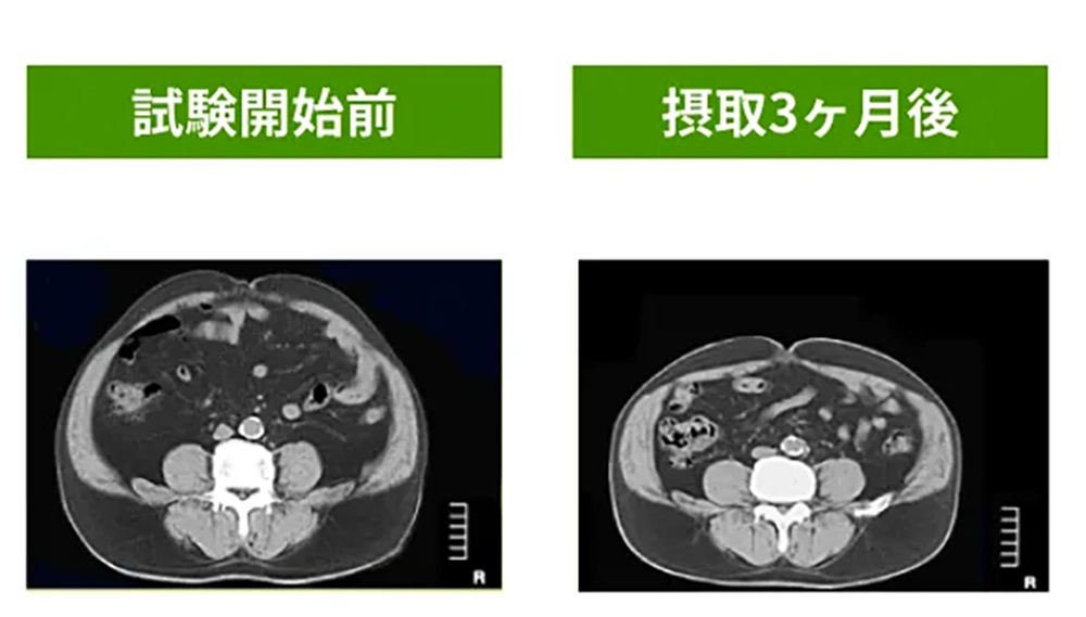 内臓脂肪への働きかけ